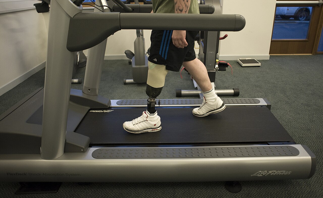 Prosthetic limb
